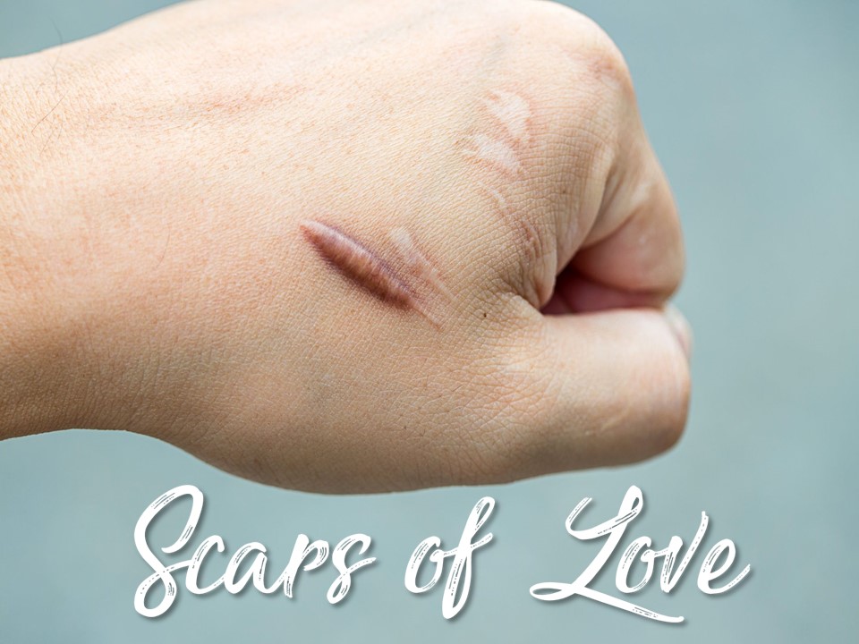 Scars of Love